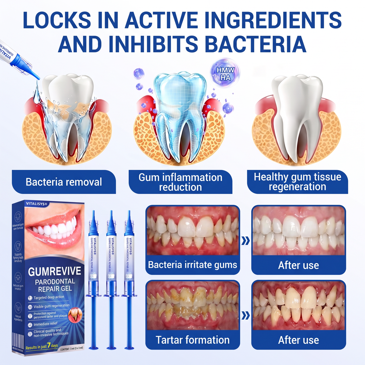 🇺🇸 VITALISYS®🦷 𝑮𝒖𝒎𝑹𝒆𝒗𝒊𝒗𝒆 Gum & Periodontal Care Gel🍇
