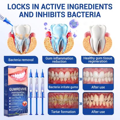🇺🇸 VITALISYS®🦷 𝑮𝒖𝒎𝑹𝒆𝒗𝒊𝒗𝒆 Gum & Periodontal Care Gel🍇