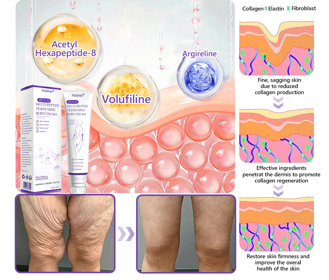 🏆FDA Official: Vitalisys® PDRN Multi-Peptide Massaging Body Roller Cream- Anti-aging, Hydrating, Skin Firming & Lifting, Skin Repair, Even Tone, Acne and Dark Spot Treatment, Wart and Mole Removal, and Psoriasis Relief.