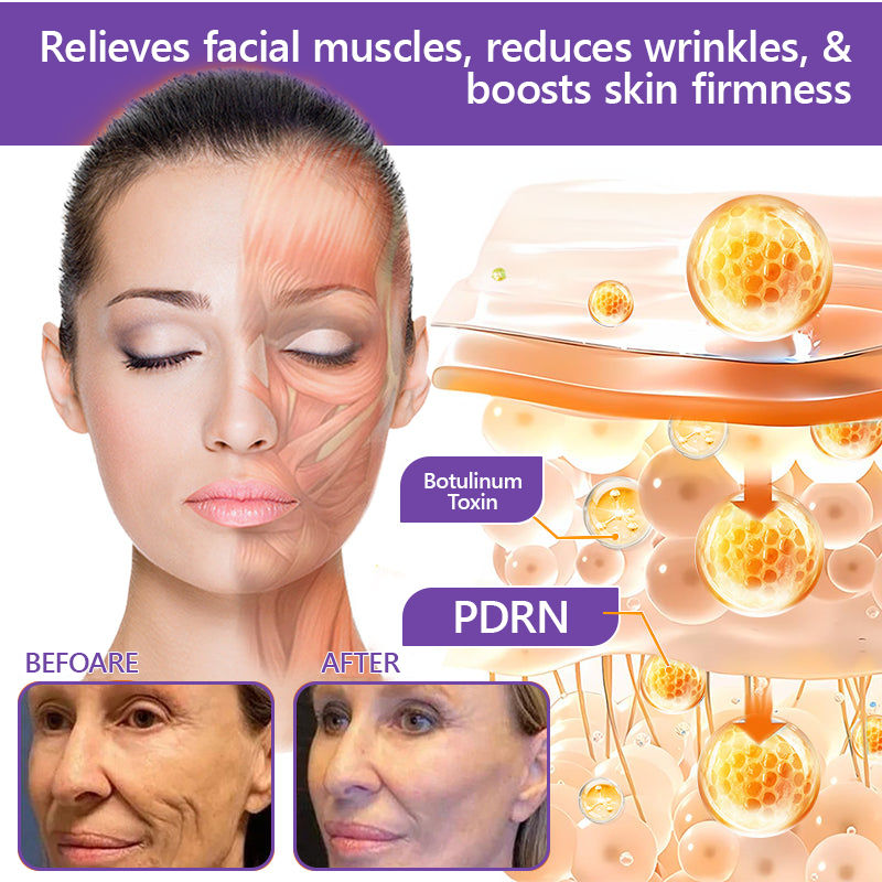 Vitalisys®🇺🇸PDRN Multi-Peptide Massaging Body Roller Cream- Anti-aging, Hydrating, Skin Firming & Lifting, Skin Repair, Even Tone, Acne and Dark Spot Treatment, Wart and Mole Removal, and Psoriasis Relief