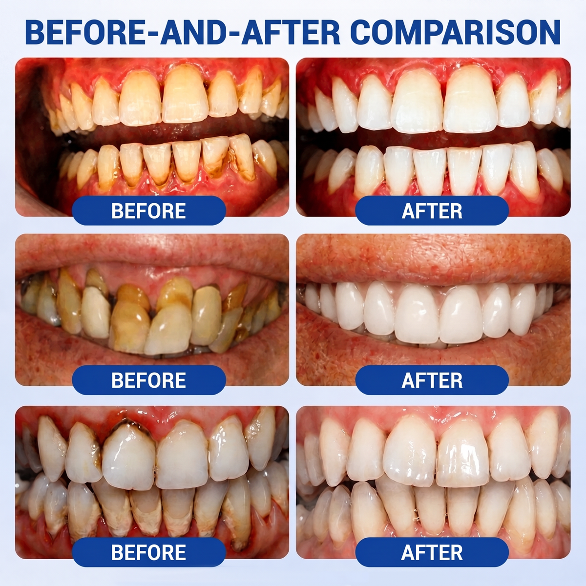 🇺🇸 VITALISYS®🦷 𝑮𝒖𝒎𝑹𝒆𝒗𝒊𝒗𝒆 Gum & Periodontal Care Gel🍇