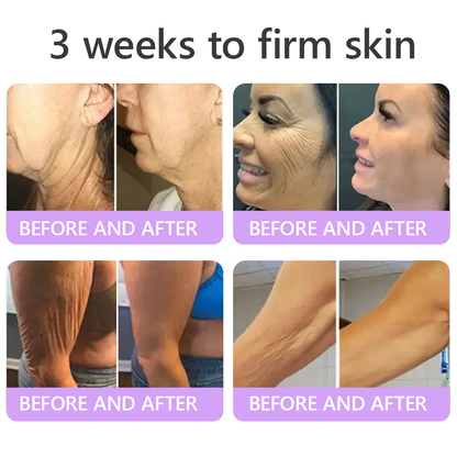 Vitalisys®🇺🇸PDRN Multi-Peptide Massaging Body Roller Cream- Anti-aging, Hydrating, Skin Firming & Lifting, Skin Repair, Even Tone, Acne and Dark Spot Treatment, Wart and Mole Removal, and Psoriasis Relief