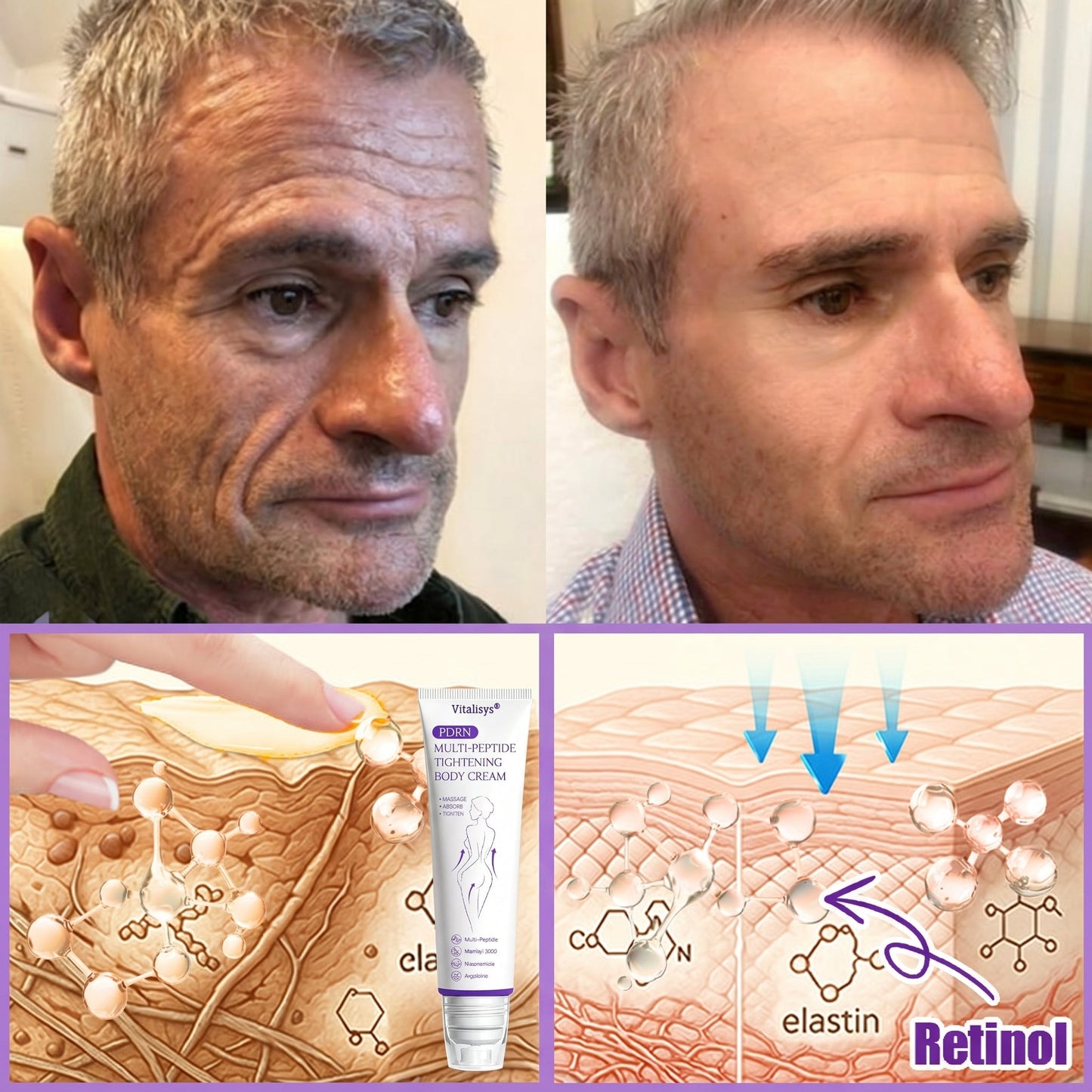 Vitalisys®🇺🇸PDRN Multi-Peptide Massaging Body Roller Cream- Anti-aging, Hydrating, Skin Firming & Lifting, Skin Repair, Even Tone, Acne and Dark Spot Treatment, Wart and Mole Removal, and Psoriasis Relief